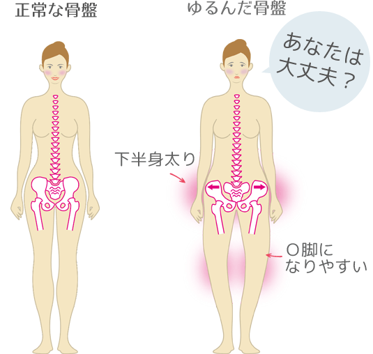 骨盤がゆるみ過ぎる現代女性の身体