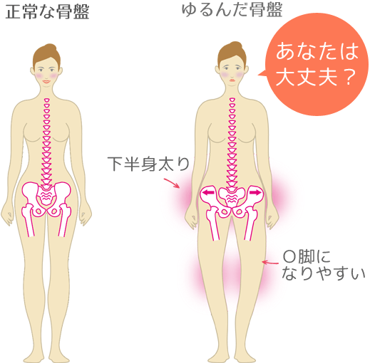産後でゆるんだ骨盤
