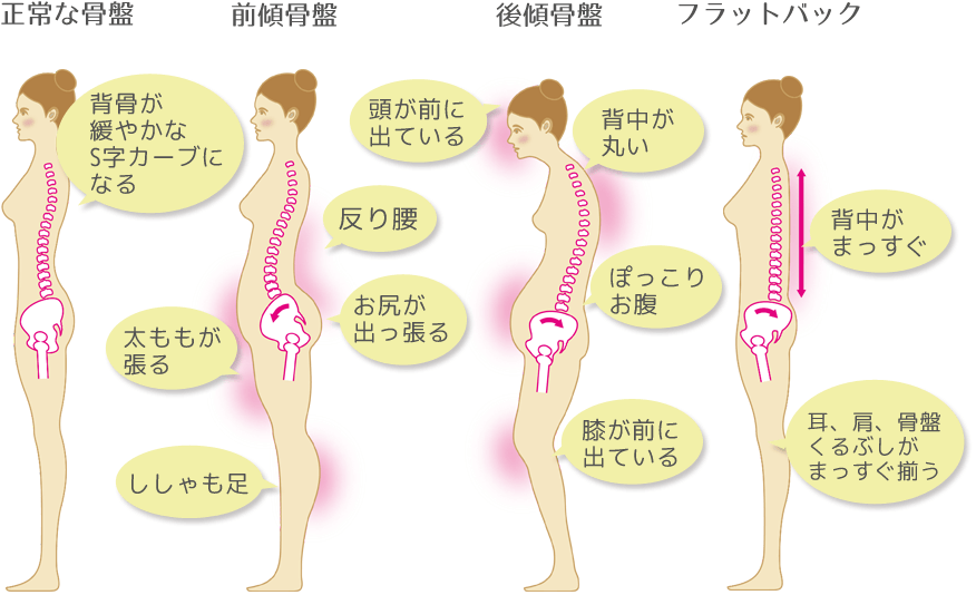 骨盤のバランス別スタイル特徴